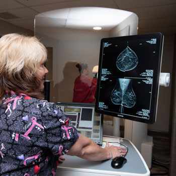 3D digital mammography